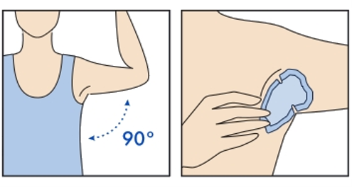 Diagram illustrating the correct 90-degree arm position for applying an underarm sweat patch.