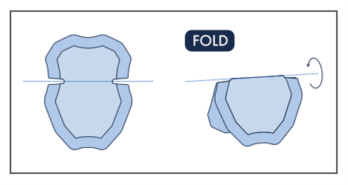 Diagram of an underarm patch showing a user folding it in half along the side notch cutouts before application.
