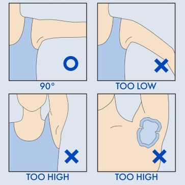 A grid of four diagrams showing the correct and incorrect arm angles to apply an underarm patch based on arm position and placement.